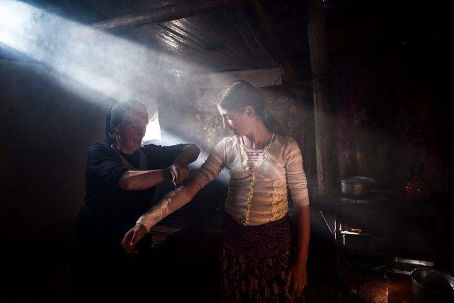 Mother putting home-made remedy on her daughter's sunburnt arm. Photo: Natela Grigalashvili